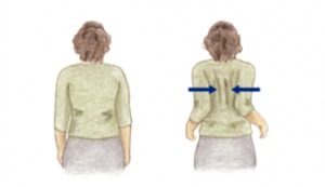 physio Back pain exercise shoulder squeeze